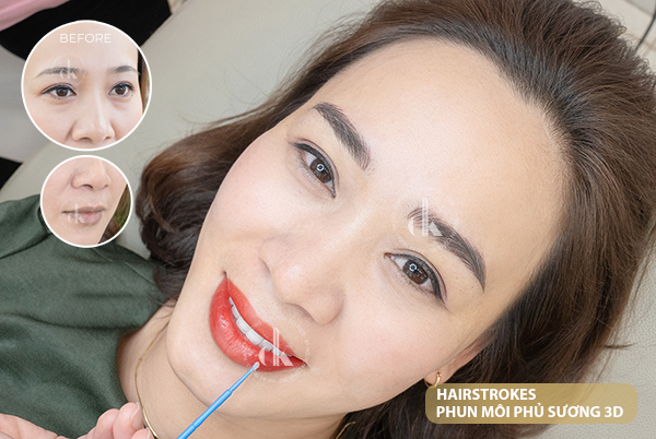 Hình ảnh trước và sau khi Phùng Khánh Linh sử dụng dịch vụ tại DK Beauty