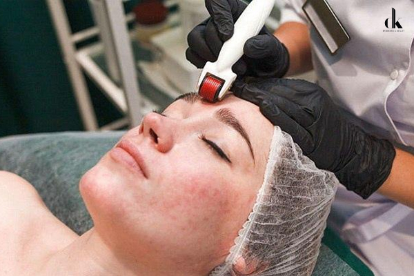 Lăn kim trị nám chân sâu là gì, hiệu quả có như lời đồn?