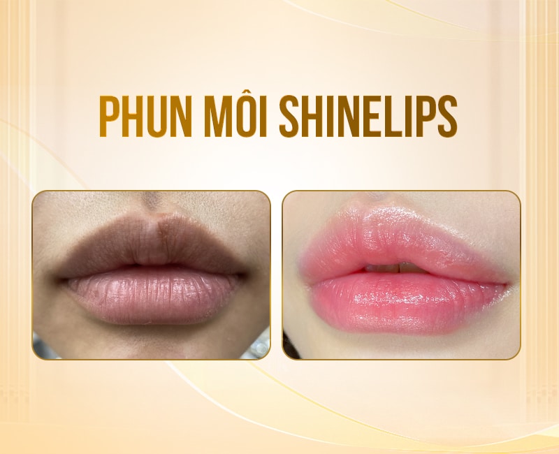 phun-moi-mau-hong-cam