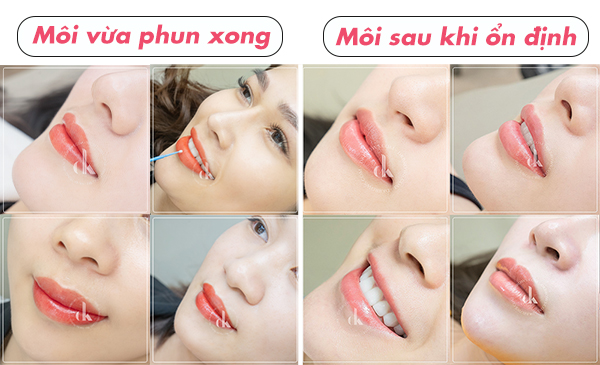 hình ảnh khách hàng trước và sau khi phun môi tại dk beauty