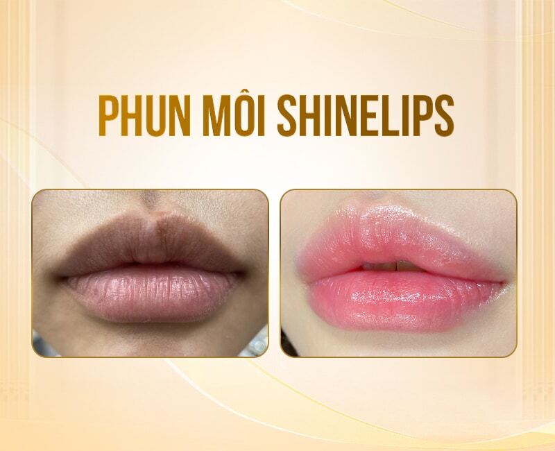 phun-moi-mau-hong-cam