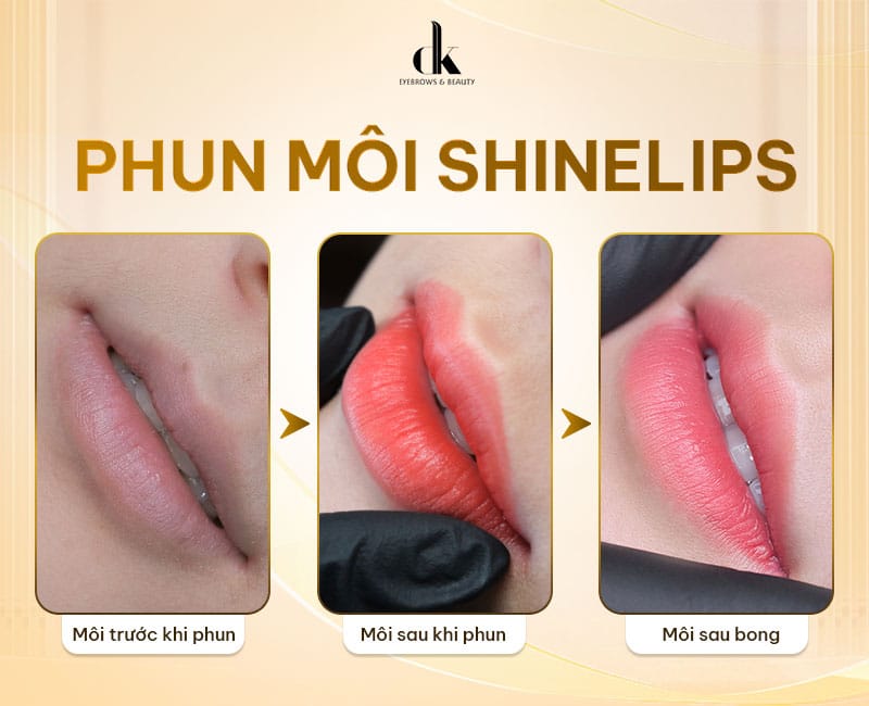 khu-tham-moi