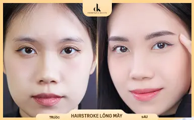 Chị Nhật Lệ – trước và sau