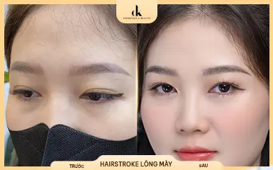 Chị Thu Nhi – trước và sau