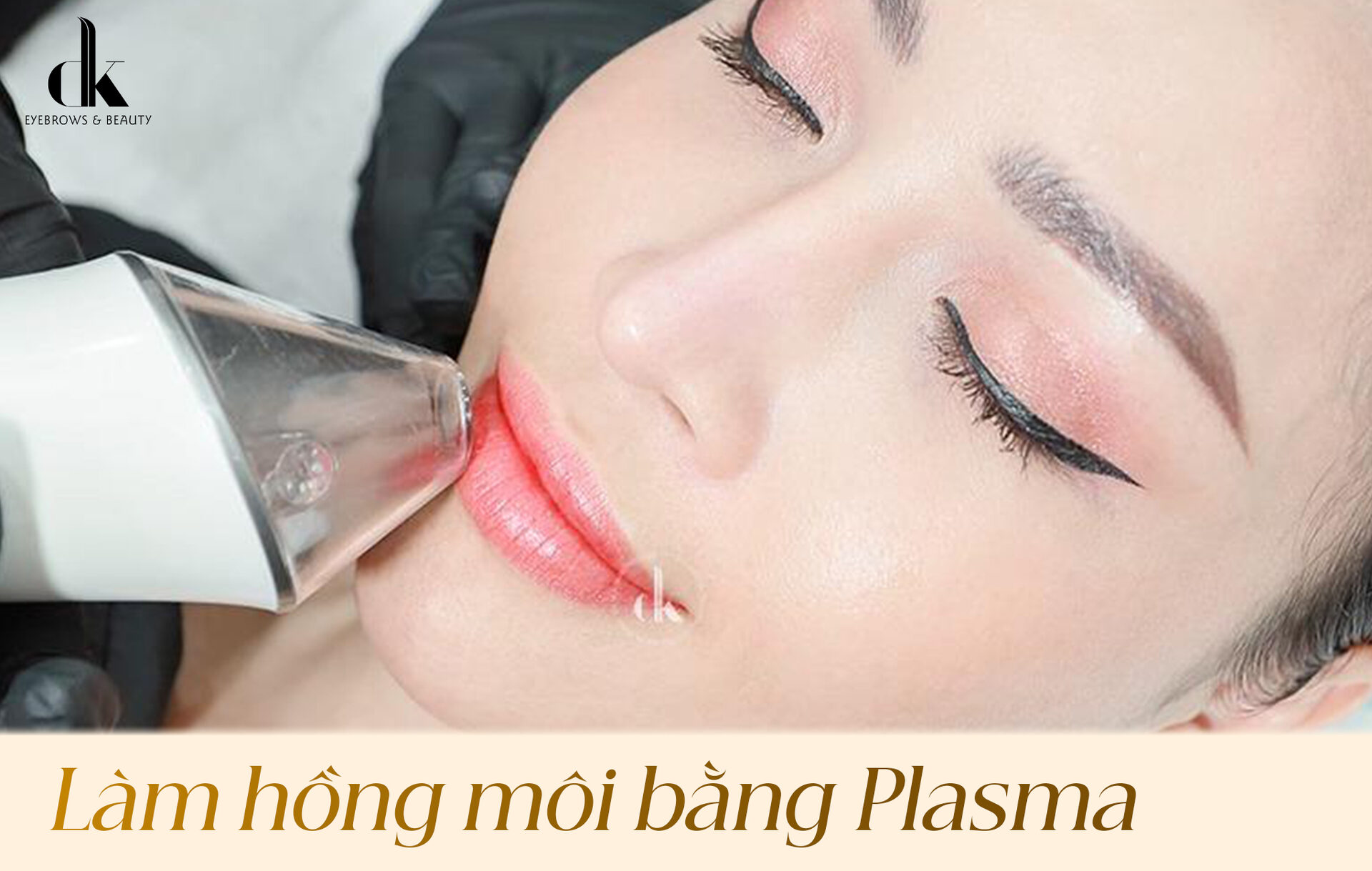 Làm hồng môi bằng Plasma: Giải pháp cải thiện môi thâm an toàn, hiệu quả