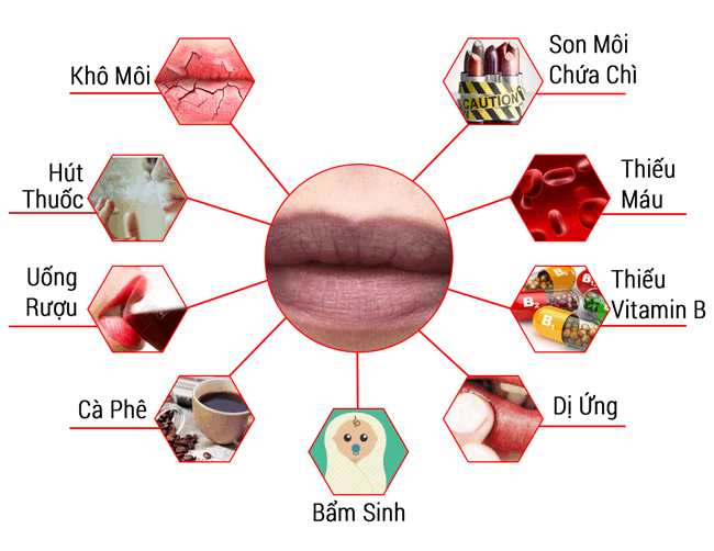 Có rất nhiều nguyên nhân dẫn đến thâm môi